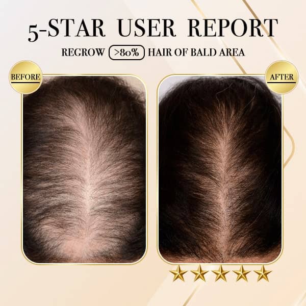 Ginger Hair Regrowth Shampoo Bar (Buy 1 Get 1 Free)