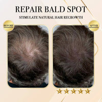Thumbnail for Ginger Hair Regrowth Shampoo Bar (Buy 1 Get 1 Free)