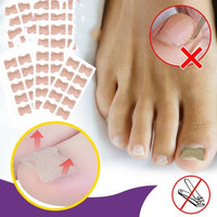 Thumbnail for Anti Paronychia Toe Relief Patches - 1 Sheet/10 Patches