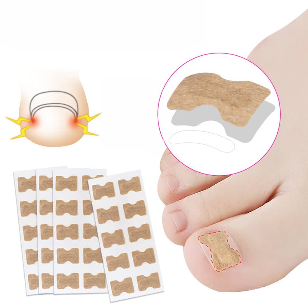 Anti Paronychia Toe Relief Patches - 1 Sheet/10 Patches