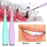 Thumbnail for Ultrasonic Tooth Cleaning Wand